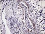 SRSF9 Antibody in Immunohistochemistry (Paraffin) (IHC (P))