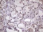 SRSF9 Antibody in Immunohistochemistry (Paraffin) (IHC (P))