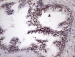 SRSF9 Antibody in Immunohistochemistry (Paraffin) (IHC (P))