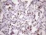 SRSF9 Antibody in Immunohistochemistry (Paraffin) (IHC (P))