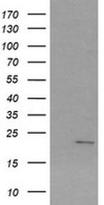 SRY Antibody in Western Blot (WB)