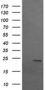 SRY Antibody in Western Blot (WB)