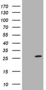 SRY Antibody in Western Blot (WB)