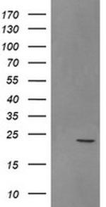 SRY Antibody in Western Blot (WB)