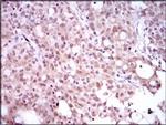 SRY Antibody in Immunohistochemistry (Paraffin) (IHC (P))