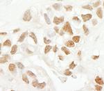 SRcyp Antibody in Immunohistochemistry (IHC)