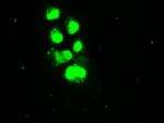 SSB Antibody in Immunocytochemistry (ICC/IF)