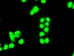 SSB Antibody in Immunocytochemistry (ICC/IF)