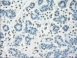 SSB Antibody in Immunohistochemistry (Paraffin) (IHC (P))