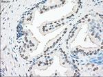 SSB Antibody in Immunohistochemistry (Paraffin) (IHC (P))