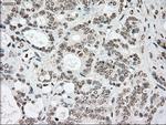 SSB Antibody in Immunohistochemistry (Paraffin) (IHC (P))