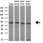 SSB Antibody in Western Blot (WB)