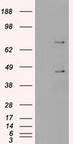 SSB Antibody in Western Blot (WB)