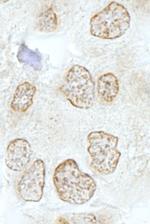 SSB1 Antibody in Immunohistochemistry (IHC)