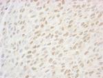 SSB1 Antibody in Immunohistochemistry (IHC)