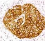 SSTR2 Antibody in Immunohistochemistry (IHC)