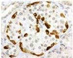 SSTR3 Antibody in Immunohistochemistry (IHC)