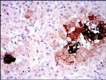 Somatostatin Antibody in Immunohistochemistry (Paraffin) (IHC (P))