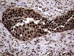 SSU72 Antibody in Immunohistochemistry (Paraffin) (IHC (P))