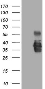 SSU72 Antibody in Western Blot (WB)