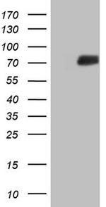 SSX2IP Antibody in Western Blot (WB)