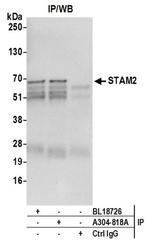 STAM2 Antibody in Western Blot (WB)