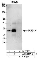 STARD10 Antibody in Immunoprecipitation (IP)