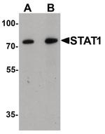 STAT1 Antibody in Western Blot (WB)