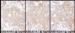 STAT2 Antibody in Immunohistochemistry (IHC)