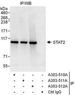 STAT2 Antibody in Immunoprecipitation (IP)