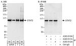 STAT2 Antibody in Western Blot (WB)