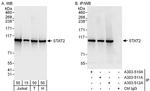 STAT2 Antibody in Western Blot (WB)