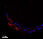 STAT3 Antibody in Immunohistochemistry (Paraffin) (IHC (P))