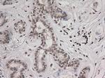 STAT3 Antibody in Immunohistochemistry (Paraffin) (IHC (P))