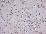 STAT3 Antibody in Immunohistochemistry (Paraffin) (IHC (P))