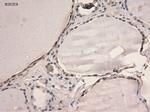 STAT3 Antibody in Immunohistochemistry (Paraffin) (IHC (P))