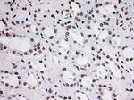 STAT3 Antibody in Immunohistochemistry (Paraffin) (IHC (P))