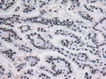 STAT3 Antibody in Immunohistochemistry (Paraffin) (IHC (P))