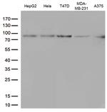 STAT3 Antibody in Western Blot (WB)