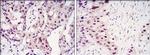 STAT3 Antibody in Immunohistochemistry (Paraffin) (IHC (P))