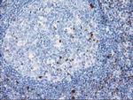 STAT4 Antibody in Immunohistochemistry (Paraffin) (IHC (P))