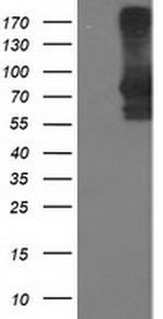 STAT4 Antibody in Western Blot (WB)