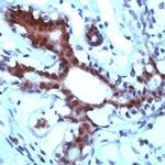 STAT5 alpha Antibody in Immunohistochemistry (IHC)