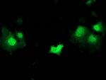 STAT5A Antibody in Immunocytochemistry (ICC/IF)