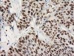 STAT5A Antibody in Immunohistochemistry (Paraffin) (IHC (P))