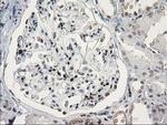 STAT5A Antibody in Immunohistochemistry (Paraffin) (IHC (P))