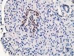 STAT5A Antibody in Immunohistochemistry (Paraffin) (IHC (P))