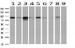 STAT5A Antibody in Western Blot (WB)