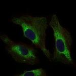 STAT5 alpha Antibody in Immunocytochemistry (ICC/IF)