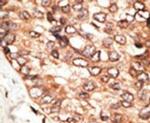 STAT5 beta Antibody in Immunohistochemistry (IHC)